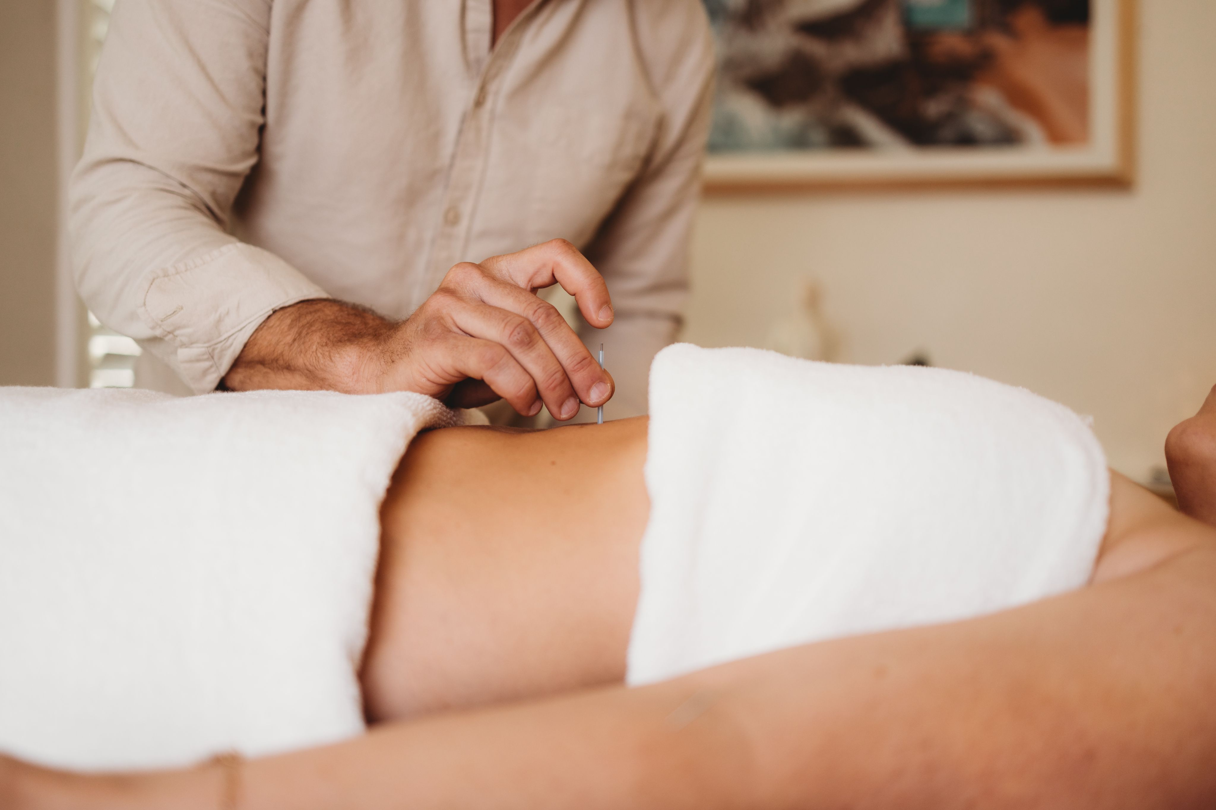 Practitioner palpating a patient's back while needling